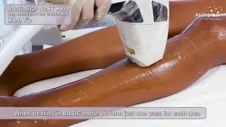 MeDioStar NeXT PRO XL - High Speed Hair removal