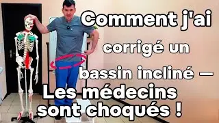 J&rsquo;ai corrig&eacute; mon bassin de travers &mdash; maintenant je bouge comme un papillon ! 🦋
