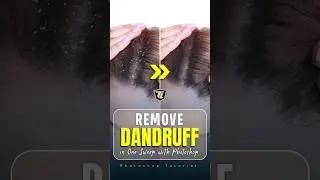 Remove Dandruff in One Sweep with Photoshop #photoshoptutorial #PhotoshopTutorial #DandruffRemoval