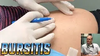 Lil' Montana's Bursitis Injections