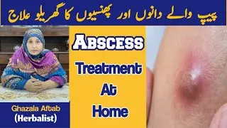 Jism Par Peep Waly Dano Ka Nikalna | Phinsi Phoron Ka ilaj | Skin Boils Treatment