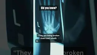 Mind-Blowing Bone Facts You Didn&rsquo;t Know! 🦴✨ #Shorts
