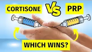 What Science ACTUALLY Says About Thumb Arthritis - Cortisone vs PRP Injection