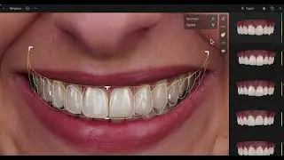 Restorative Space - Customise Smile Design