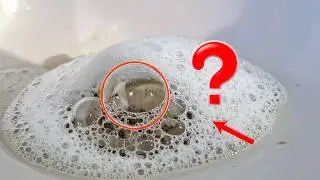 Top 5 Reasons Of Foamy or Bubbly Urine  One Is Kidney Disease!