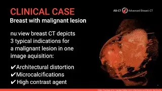 Clinical Case: Breast CT images with contrast media enhancement