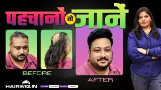 Men Hair Patch |#transformation  #gorakhpur #PinkiSingh #Hairwig #lucknow #trending #viral #hairwig