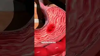 &iquest;Por Qu&eacute; Vomitamos?
