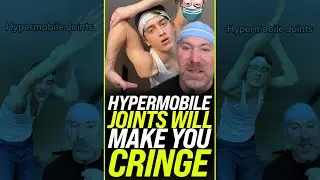 Hypermobile Joints Will Make You Cringe 😱 #shorts