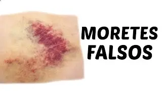 MORETES FALSOS-  FACIL HALLOWEEN