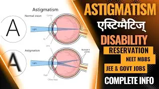 Compound Myopia Astigmatism एस्टिग्मैटिज्म BCVA PwD Disability Reservation Neet Jee Govt Exams SVP