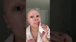 GRWM: Why I’m bald edition👩🏼‍🦲