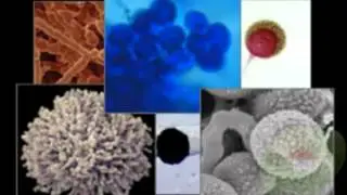 What Does A Mold Inspection Price in Tampa FL