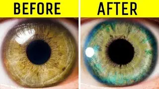 How To Improve Eyes Health | Natural Ways To Improve GLAUCOMA