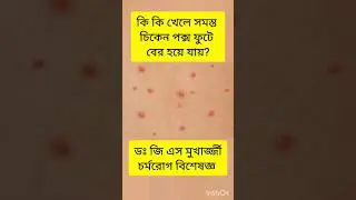 Chicken pox #dermatologist #doctor #skinspecialist #health #bangla