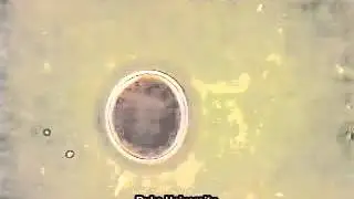Top view of a colorimetric glucose assay