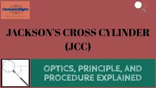 Jackson Cross Cylinder: Optics, Principles, and Procedure Explained