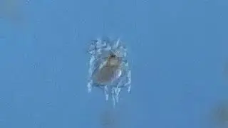 Rotifer forming an egg in its environment (Brachionus sp. - patulus?)