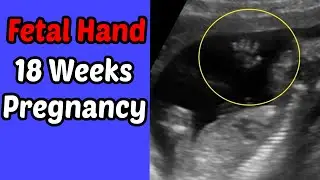 Fetal Hand | 18 weeks pregnancy