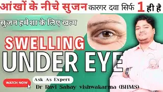 Swelling under one eye treatment | Swelling under eyes home remedy