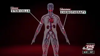 Doctors testing experimental therapy that could be lifesaving for patients with sickle cell dise...