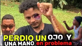 ESTE HOMBRE CASI PIERDE UN BRAZO Y UN OJO EN UN PROBLEMA CALLEJERO 🤯