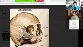Drs. Vaughan and Ting Complete Interview on MSE Surgical Assist