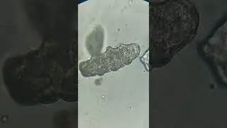 A #ciliate and a #waterbear ( #microscopic #biology #life #microworld #microart #pondlife )