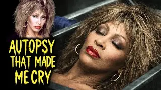 The Autopsy of Tina Turner | The Untold Story Behind Her Final Chapter