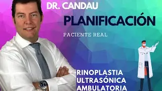 Asi planificamos una Rinoplastia Ultrasónica - Dr Candau