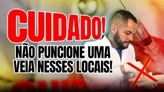 Locais que não pode puncionar uma veia