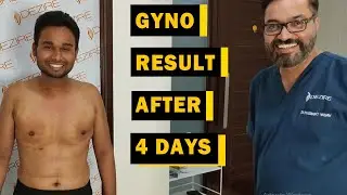 My Gynecomastia result after 4 days