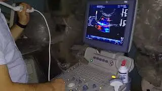Testing Logiq P5 with convex + TV probe