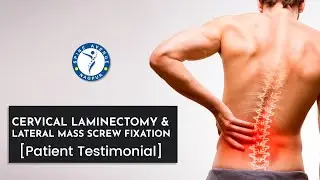 Cervical laminectomy and lateral mass screw fixation.