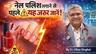 Nail Polish & Hidden Diseases Explained by Dr. Vikas Singhal