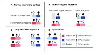 Imprinting Syndromes ||Types ||Investigation