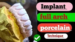 Implant full arch porcelain|| dental technician| implant anatomy| dental technician video| ceramic||