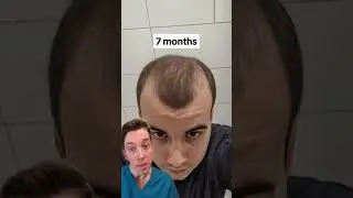 Calling BS on &ldquo;Just Minoxidil&rdquo;?