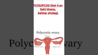 #pcod #pcodkyahai#pcodsupport #pcod diet#viral
