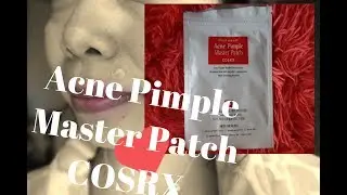 Pimple no more!,Acne Pimple Master Patch COSRX review :)