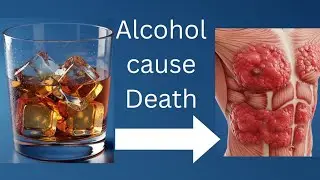&ldquo;DO NOT Ignore This: What Alcohol Does Inside Your Body Is Terrifying&rdquo;