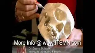 Craniofacial Pain and Headaches