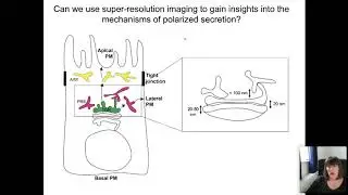 Aurox Conference on Microscopy Day 1 Session 3 SuperResolution