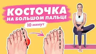 Как убрать КОСТОЧКУ на большом пальце ноги? | Профилактика ПЛОСКОСТОПИЯ | Всего 10 минут в день!