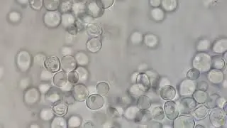 Yeast cells of Candida at high power microscopy(4000X)