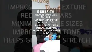 Microneedling &ndash; Dallas Texas &ndash; Timeless Beauty Med Spa #skincare #facial #beauty #skincareroutine