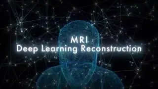 Introducing the world&rsquo;s first Deep Learning Reconstruction for MR