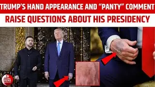 Trump Hides Bandaged Hand? Questions Grow Over the 79-Year-Old President&rsquo;s Future