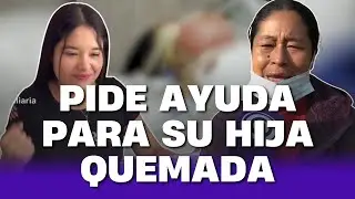 Madre clama ayuda por joven quemada por delincuentas en Chicama