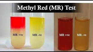 Methyl Red MR test and the MR VP test differentiate bacteria metabolic pathways of glucose fermentat